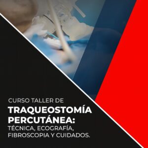Traqueostomía Percutánea MENDOZA